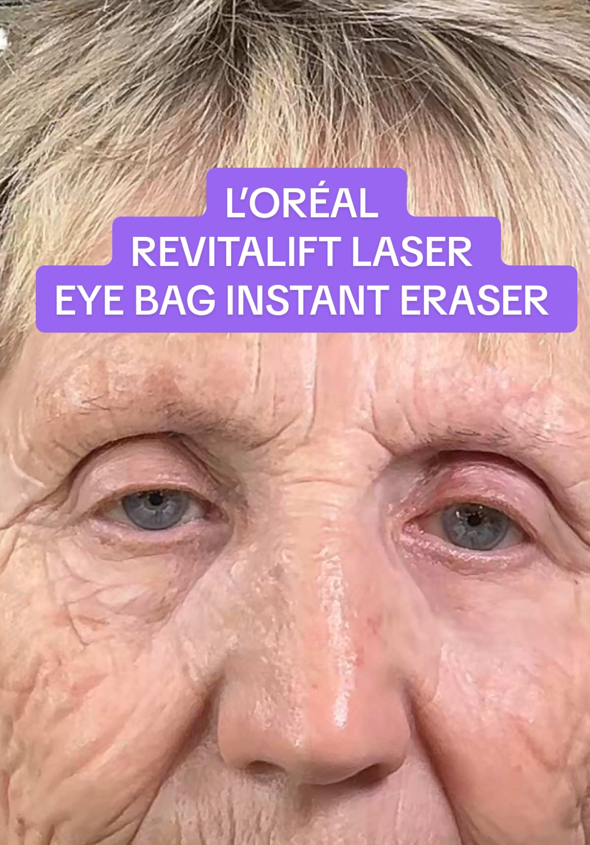 #fyp #tiktokmademebuyit #flashsale #loreal #skincare #eyebags #wrinkles #lorealpariseyebageraser @L'Oréal Paris UK 
