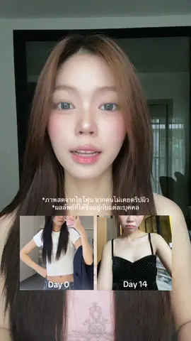 ผิวใสจนคนทักว่าใช้ฟิลเตอร์ แต่นี่ผิวจริงง😍💪🏻✨ #ไอเทมฮิต #รีวิวเด็ด #ของมันต้องมี #ป้ายยาtiktok #รีวิวบิวตี้ #วิตามินดริปผิว #bloodorange 