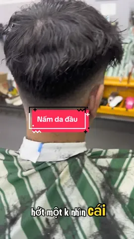 Nấm gầu quá nặng #antisol #daugoitrigau #daugoitrinam 