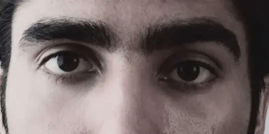 eyeareapill #bp #blackpil #looksmax #eyes #looks #viral #fyp 
