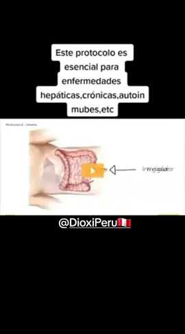 COMO SE HACE UN ENEMA CON CDS ?  PROTOCOLO E @Andreas Kalcker  #enemas #prostata #cancer #hemorroides #fypシ #xyzbca 