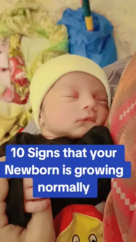 normal growth signs of newborn baby #newbornbaby #newborncare #momsandminis #momsandminis05 #rateebbintalha 