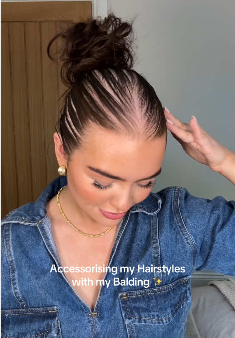 I love my speed lines 🫶🏼✨ who says thinning hair isn’t cool!!!!!!???? #alopecia #thinhairhairstyle #alopeciaacceptance #grwmalopeciaedition #femalebalding #thinninghair #androgenicalopecia 