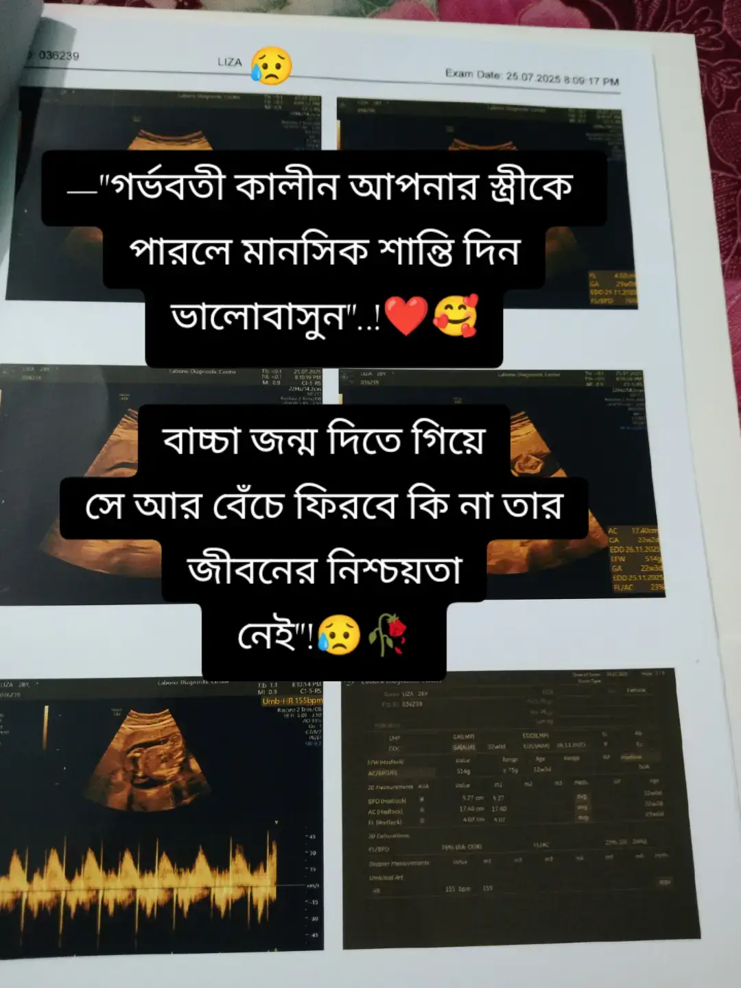 #foryou #foryoupage #tiktokbd #tiktokofficial #titokbangladesh #viralvideo 