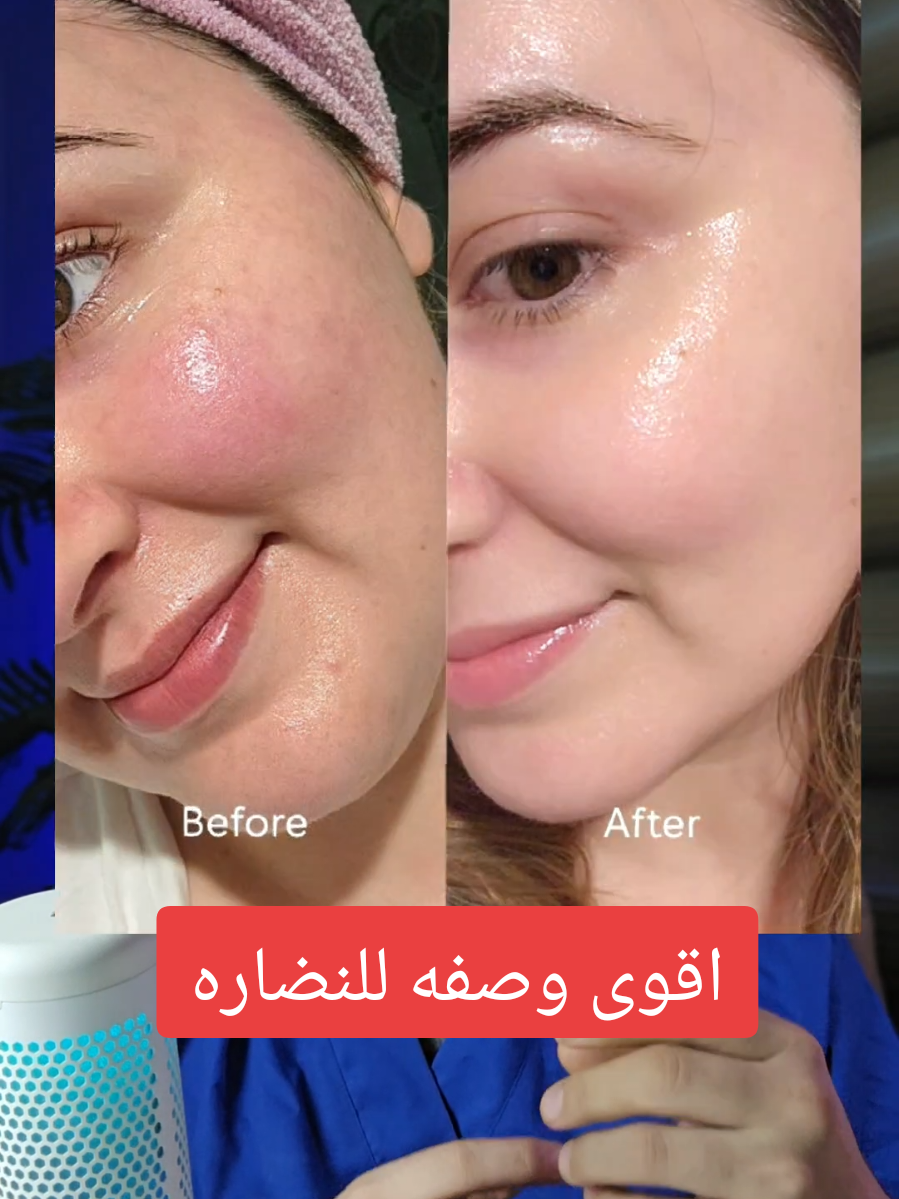 اذا جان عدج سؤال او استفسار اتركي بلتعليقات واني اجاوبج #تجمي #فلر #وصفات #تفتيح #تبيض #روتين #الشعب_الصيني_ماله_حل😂😂 