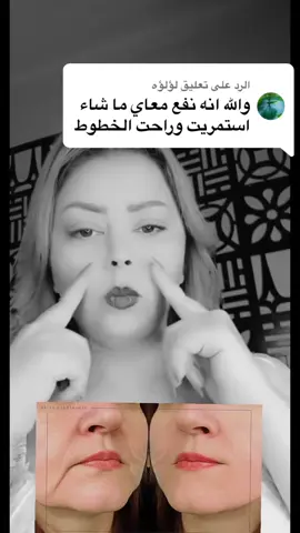 الرد على @لؤلؤه #foryou #viral #fyp #رشا_عادل #شياتسو #تجاعيد #جواشا #مصر_العراق_السعودية_تونس_المغرب_الجزائر #ti̇ktok #google 