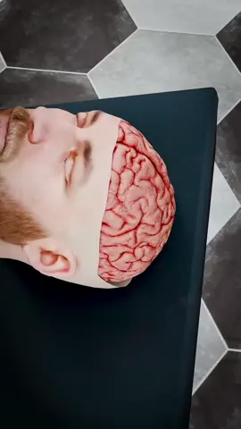 why a brain transplant isn’t possible?  #braintransplant #braintumor #braincancer #braincancerawareness #braintransplantsurgery #brainsurgery #medical3danimation #3dmedicalanimation 