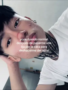 es broma pero estoy tan harto de él que podría ser lo  siguiente que haga  #acnetrauma #acné #trauma #humor #fyp 