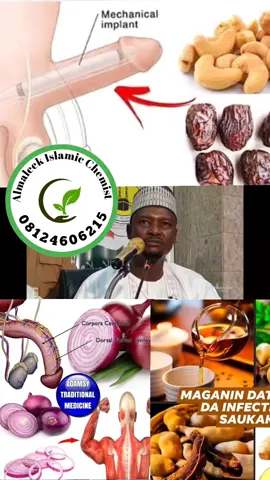 MATSALA NA AMRADUL UDWI  #fyp #viral #videos #reels #tiktok 