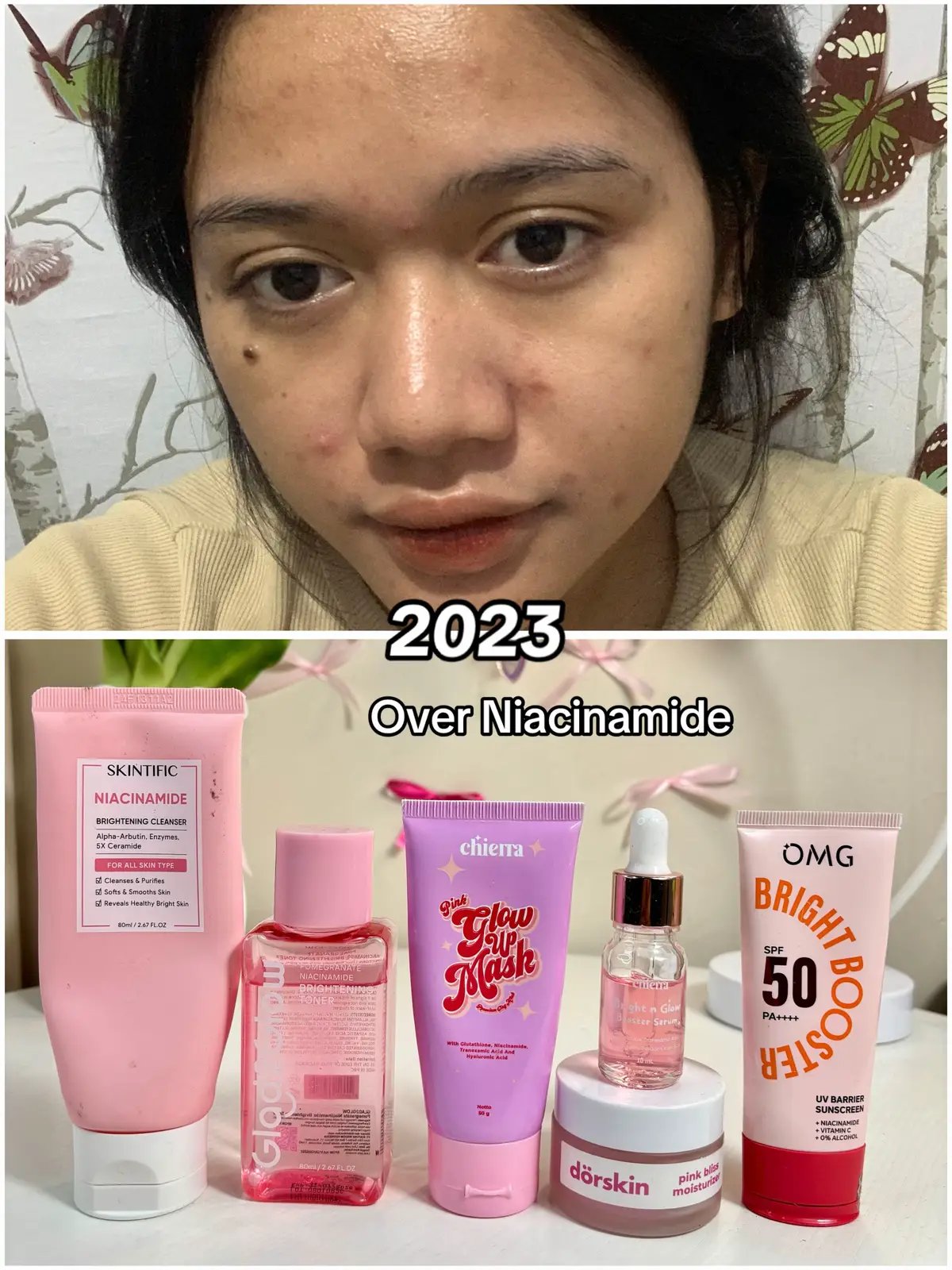 Jangan sampai over Niacinamide😭#skincare #skincareroutine #skincaretips #skincareviral #skincareproducts #rekomendasiskincare #skincaretiktok #fyp #4u #trending #viral 