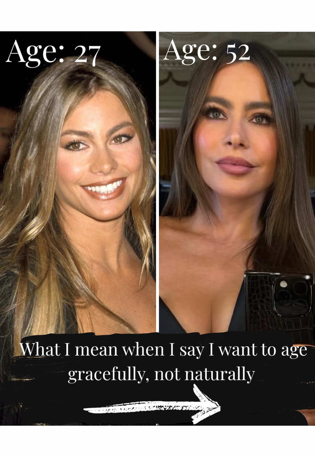 I’m not “anti-aging” I’m just pro- doing whatever makes you feel good in your skin.  #greenscreen #sofiavergara #aestheticnurse #nurseinjector #fyp #skincare #spf 
