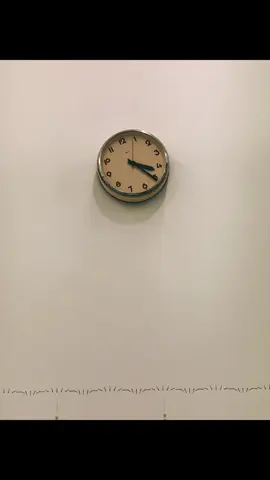 Deja vu 236: Time #agnod #foryou #fyp 