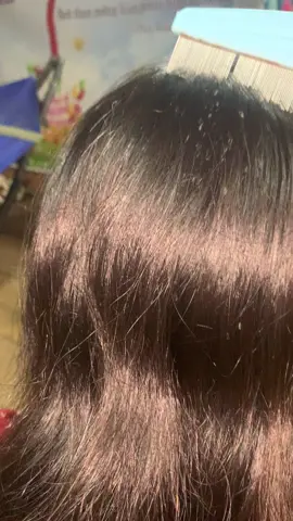 😱😱#omg #for #lice #liceremoval #treanding 