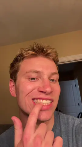 ❤️ 🦷 😃 @BodyAccel US 