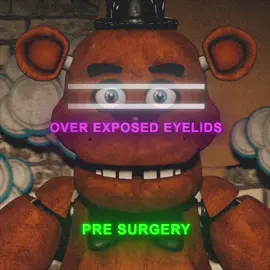 same endoskeleton btw ✌️ #edit #alightmotion #like #repost #follow #fyp #fnaf #freddyfazbear #fnaf1 #fnaf2 #fnaf3 #fnaf4 #witheredfreddy #bonnie #chica #foxy #looksmax #bp #hardmax #mogger #mogged #springtrap #balloonboy #music #shakeedit #mog #mogger 