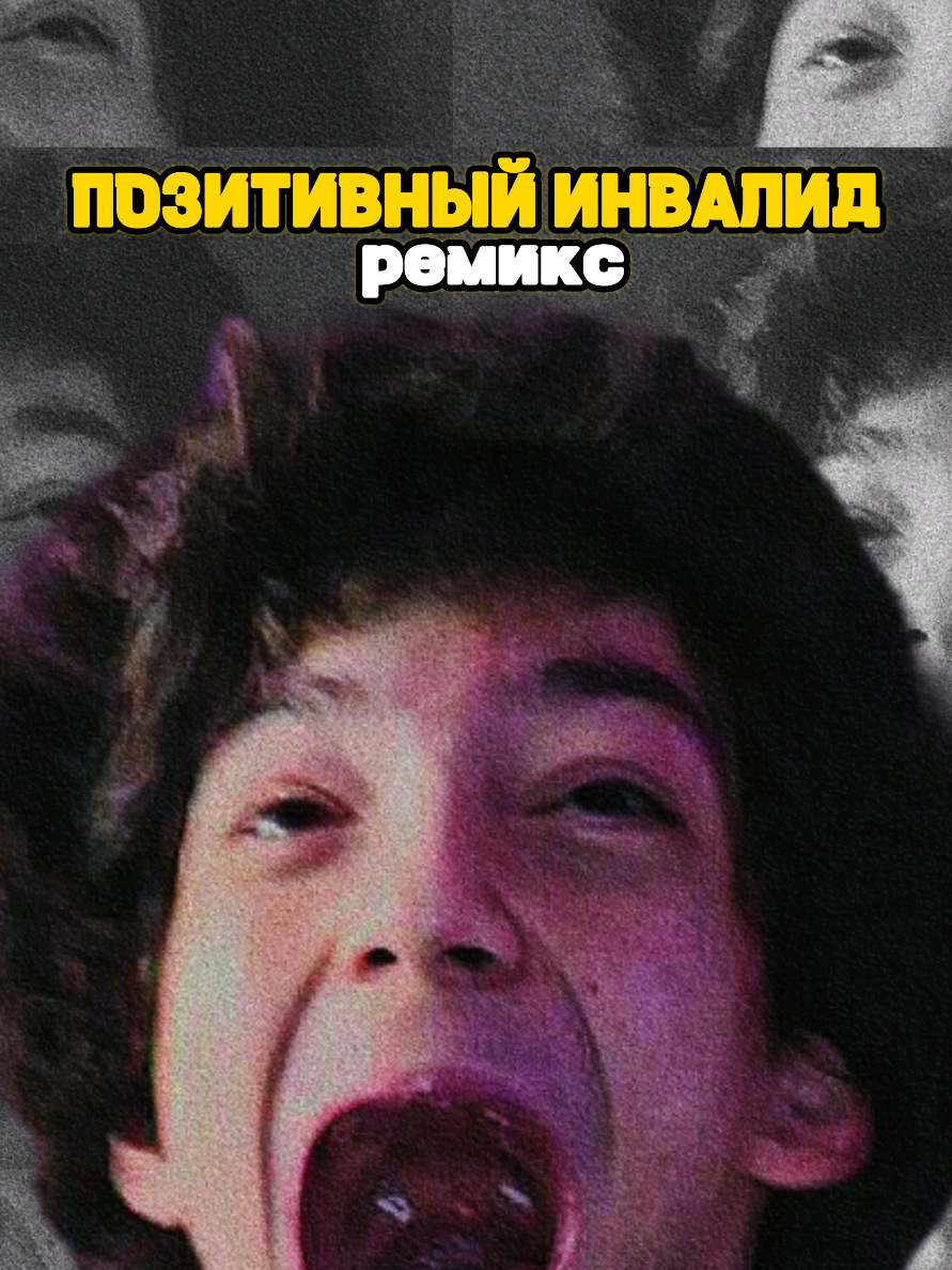 🎵 Позитивный Инвалид (Remix) 🎵 Подписка на гения - @Ayzer 