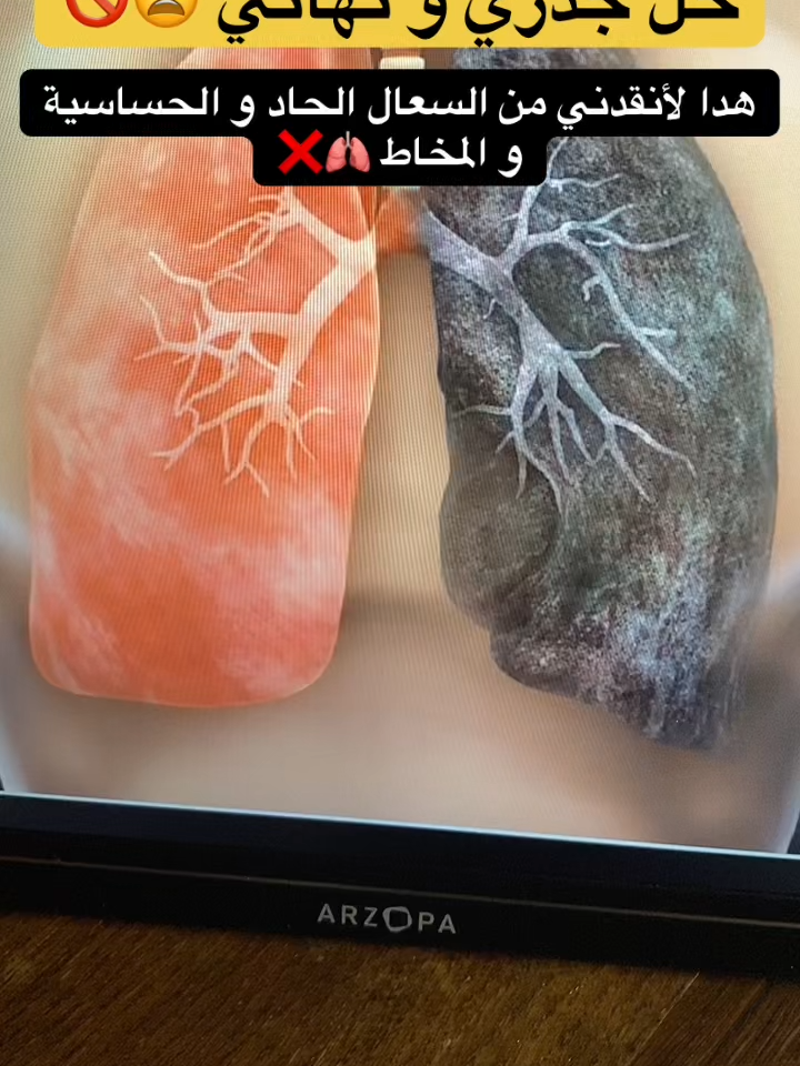 #ضيق_تنفس #علاج_الرئة #القصبة_الهوائية #السعودية🇸🇦 #explorepage✨ #تيك_توك_عرب #الرياض_الان_24 #الدمام_الخبر_الشرقيه #ضيق_التنفس #جدة_الان #استشارات_طبية #الربو #البلغم #الشعب_الصيني_ماله_حل😂😂 #رئة #رئتين
