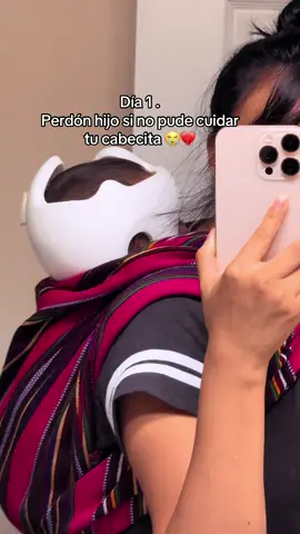 Perdón hijo si no pude cuidar tu cabecita tuvo que poner el casco mi bebé de 7 meses realmente como madre me siento triste a la vez culpable 💔😭😭😭😭🥹