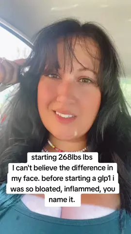 before & after starting a glp1. face transformation #glp1 #glp1forweightloss #glp1community #onthisday 