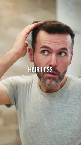 How I can tell a guy's hair loss is starting🚨 #renewoklahoma #aesthetics #menshealth #wellness #health