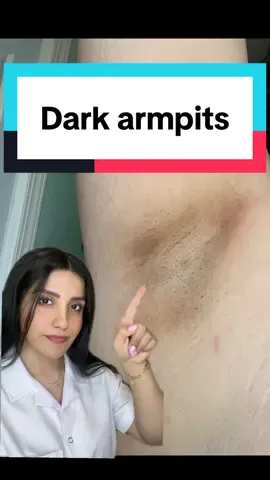 ✨ Say goodbye to dark underarms! @Eqqualberry Vitamin Illuminating serum is packed with brightening vitamins that help fade pigmentation, even out skin tone, and leave your underarms soft, smooth, and visibly brighter.  No harsh chemicals — just gentle, effective care 💖 #darkarmpits #darkunderarms #armpits #underarm 