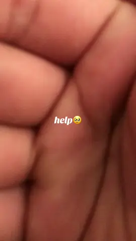 #fyp #tiktok #help 