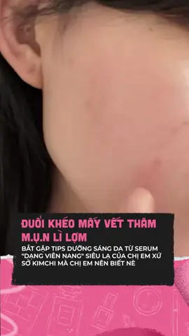 Rinh liền em này giùm tui #clbeauty #clmedia #celebnetwork #beauty #goclamdep #beautytips #BeautyTok #skincare #abib #serum