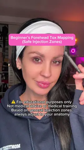 Beginner’s Forehead Tox Mapping (Safe Injection Zones) ⚠️For educational purposes only  Not medical advice or medical training Based on general injection zones, always adjust to your anatomy