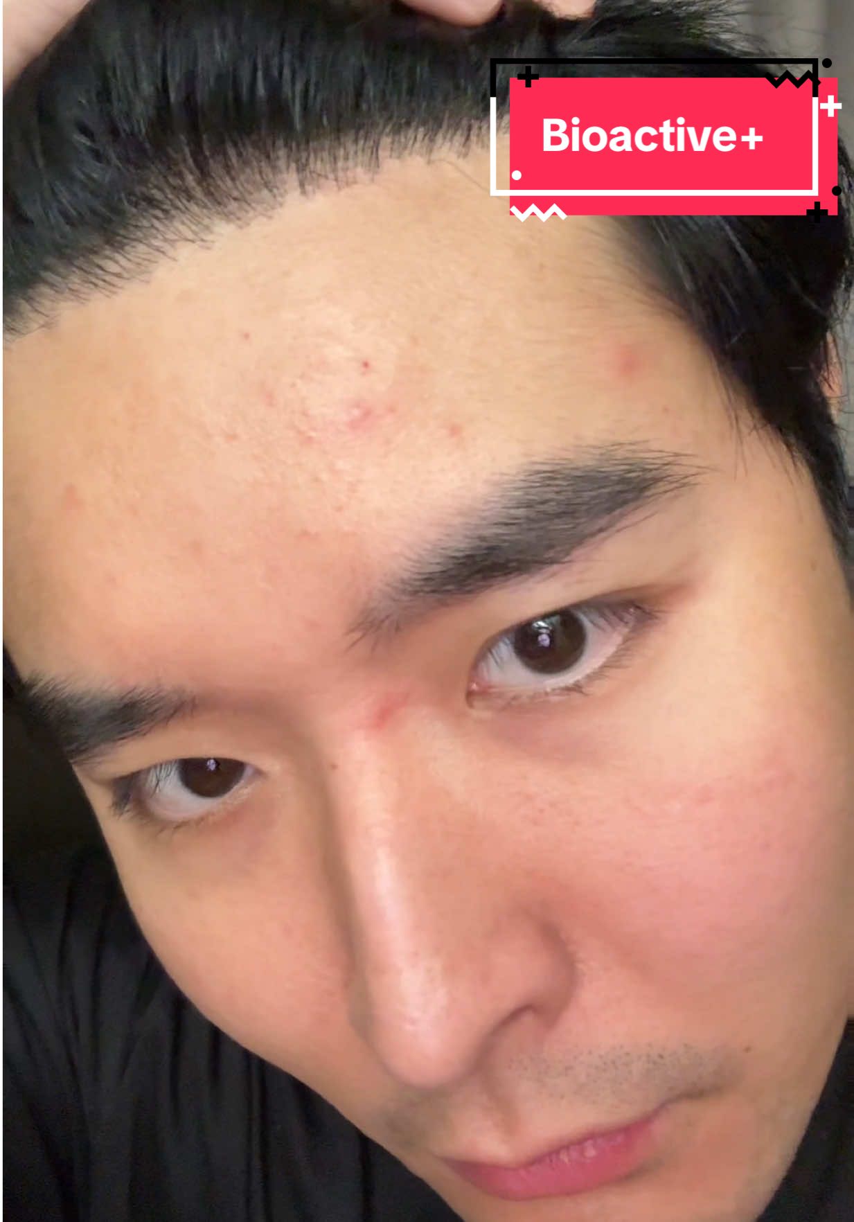 ลองทำ Challenge 10 วันกิน Bioactive ตามกระแสว่าจะเห็นผลจริงมั้ย!?😁🤔 เห็นมาแรงละเกินนนน #concentratedliquidcollagen #คอลลาเจดรอปดริ้งค์ #ผิวดีได้แค่dropและdrink #bioactiveplus #bioactiveth 