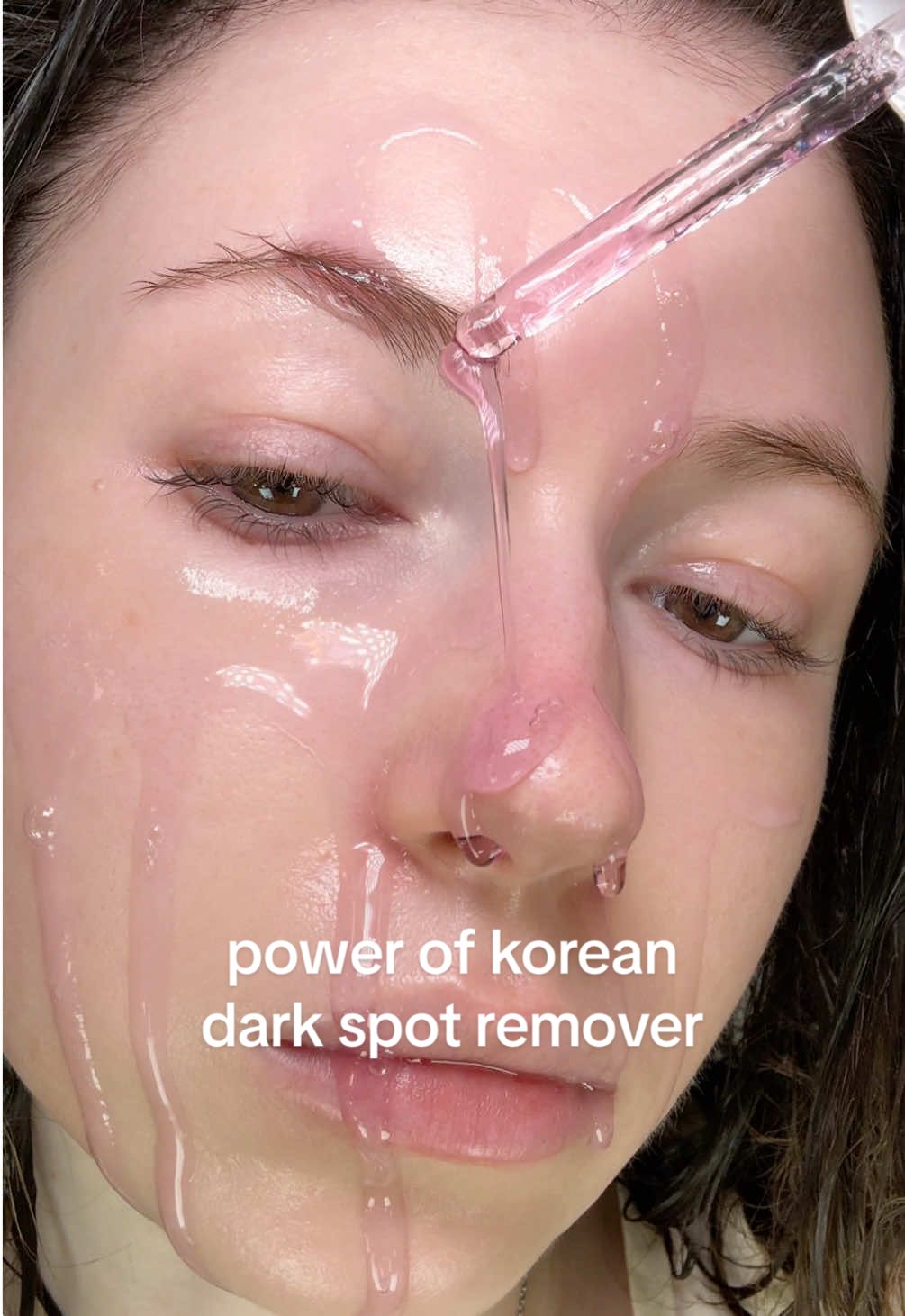 Removing dark spots with Jumiso dark spot remover serum 💜 #JUMISO #Niacinamide #DarkSpotRemover #hyperpigmentation #SkinTransformation @Jumiso Official 