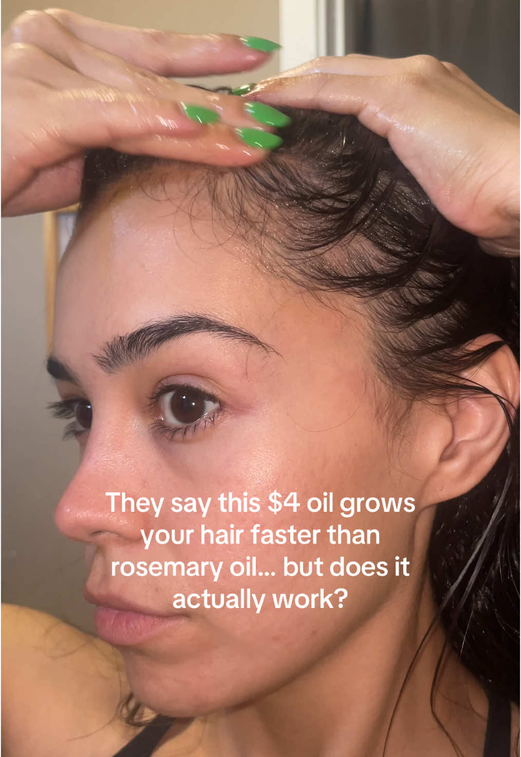 Trying amla oil 3x a week to see if it actually grows my hair… TikTok better not have lied to me! #fypシ #amlaoil #hairgrowthjourney #hairlossremedy #hairlosssolutions #hairloss #hairlossjourney #highporosityhair #lowporosityhair #hairoiling #hairoilingroutine #thickhair #thickhairtips #scalpcare #fyp #hairgrowthtips #hairgrowthjourney #hairgrowthoil #hairgrowthoils #longhair #hairstyle #hairstyles #girlhairstyle 