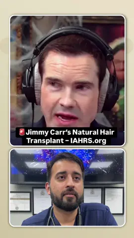 Celebrity hair transplants are often hit or miss… But comedian Jimmy Carr? He nailed it. ✅ He chose a local clinic — avoiding the risks of rushed surgeries abroad ✅ He didn’t drop his hairline too low — it’s age-appropriate and natural-looking ✅ The density suits his features — not overdone, not pluggy ✅ He avoided the “turkey strip” look — and kept his hair transplant private until he was ready to reveal it 🎯 And he even joked about the hair on the back of his neck now living at the front. That sensation? Slightly real. But it’s not common — and definitely not uncomfortable when done right. At Royal Wharf Clinic, we help you get natural, invisible, lifelong results without flying abroad, risking poor aftercare, or looking overdone. 📲 Want a professional opinion on your hair? Comment “hair” and we’ll send you a free consult link. Or book directly: 🌐 www.royalwharfclinic.co.uk 📞 020 4513 1960 📲 WhatsApp: +44 7442 129192 #hairtransplantuk #jimmycarrhairtransplant #celebrityhairtransplant #hairrestorationlondon #fuehairtransplant #royalwharfclinic #drshaanmbbs #hairtransplantsurgeon #naturalhairline #hairlosshelp #menshairjourney #londonhairclinic 