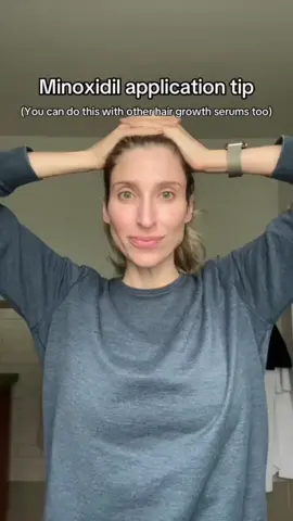 Tips and tricks. As someone who personally deals with hair loss and as someone who specializes in treating it, I have so much firsthand experience with what really works. Hair loss can be incredibly stressful and demoralizing, and I will always be here to support you on that journey!  ##hairloss##balding##thinhair##minoxidil##hairgrowth