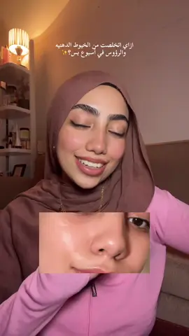 يلا مش خساره فيكم😂❤️ #مرنونه #skincare #blackheads #tipsandtricks 