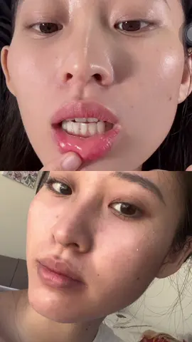 Sài riết bị ghiền hehe #moikhonutne #yuvias #taytebaochetmoi #yampoule 