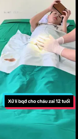 Xử lí bqđ cho cháu zai 12 tuổi rất êm ái nhé mọi người #tuvannamkhoatoanquoc #hepbaoquydautreem #circumcision #namkhoa #loiichcatbaoquydau #daibaoquydau #tiktokviral @Tư Vấn Nam Khoa Toàn Quốc 