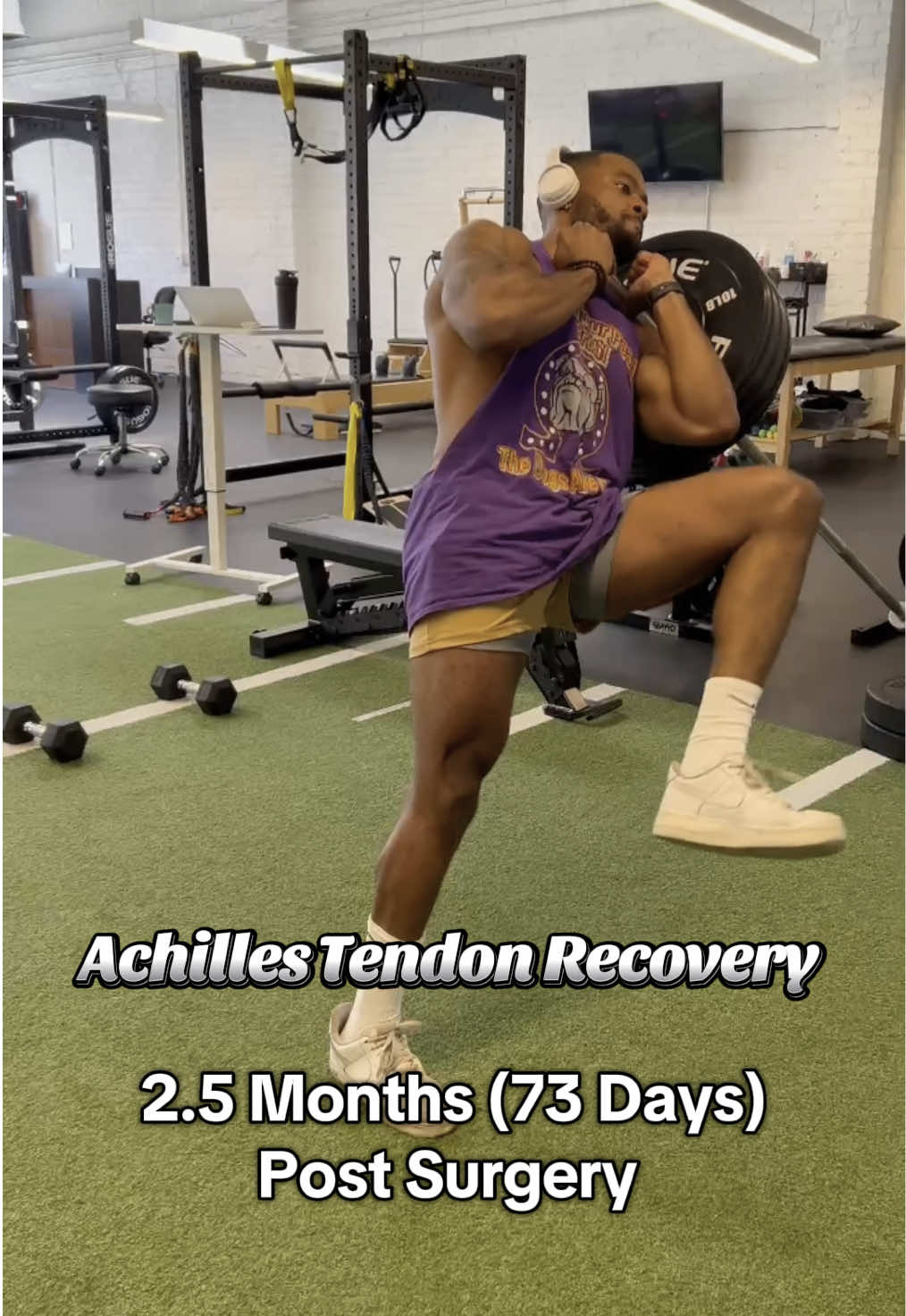 Achilles Tendon Recovery. Day 73.  May 9 2025- July 28 2025 I was unlucky enough to tear both Achilles (first one 4 years ago) but lucky enough to have a great surgeon and great rehab around me.  The process is long but if you stay focused & take it a day at a time you will come back even better than you were before! Stay Positive & Stay Locked In‼️ #Fitness #fitnessmotivation #workout #gymmotivation #achilles ##achillesrecovery#explore 