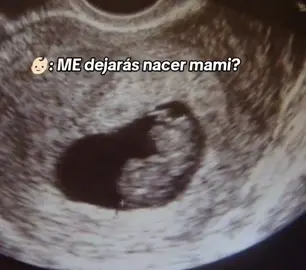#embarazonodeseado #embarazonodeseado #paratii 