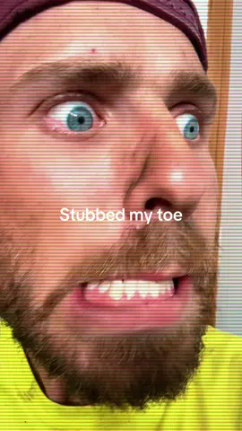 Ouch my toe, it’s been stubbed