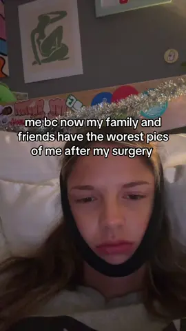 they are so bad 🥸😺 #wisdomteeth #fyp #share #comment #help #fypシ゚viral #repost