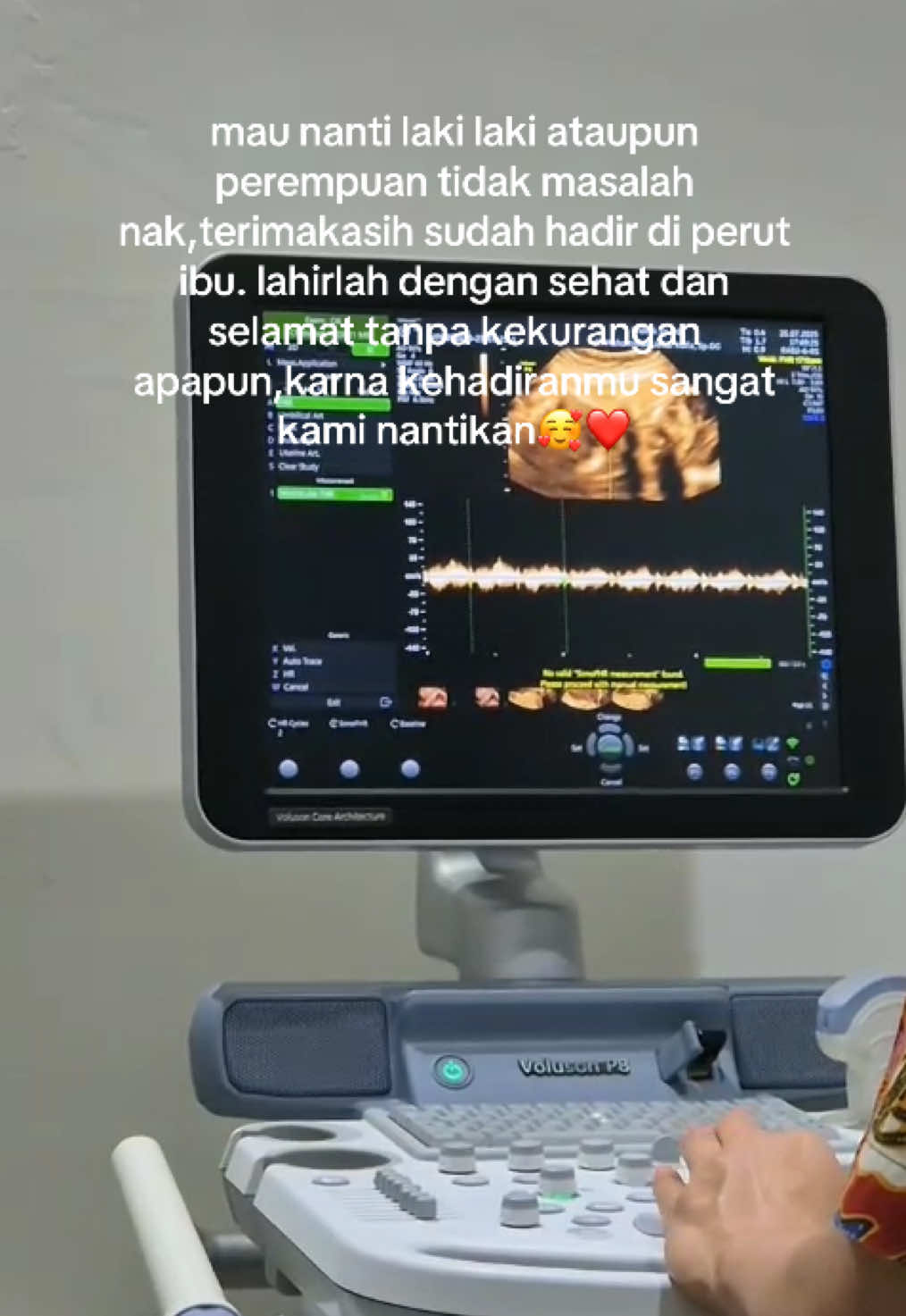 masya allah HPL semakin dekat,sehat2 di perut ibu ya nak sampe nanti waktunya tiba🥹🥰❤️ #fyp #masukberandafyp #padahariini #pregnant #bumilsehatbayisehat🤰♥️😘😘 #hploktober #bumilhappy 