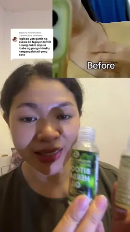 Replying to @RowenaBolo Cajomocan malaking tolong talga nitong bitoon herbal oil sa akin nong nagka bukol ako sa leeg,.finally nawala narin ❤️🙏🥹 #bitoonherbaloil #herbal #oil #goiter #cyst 