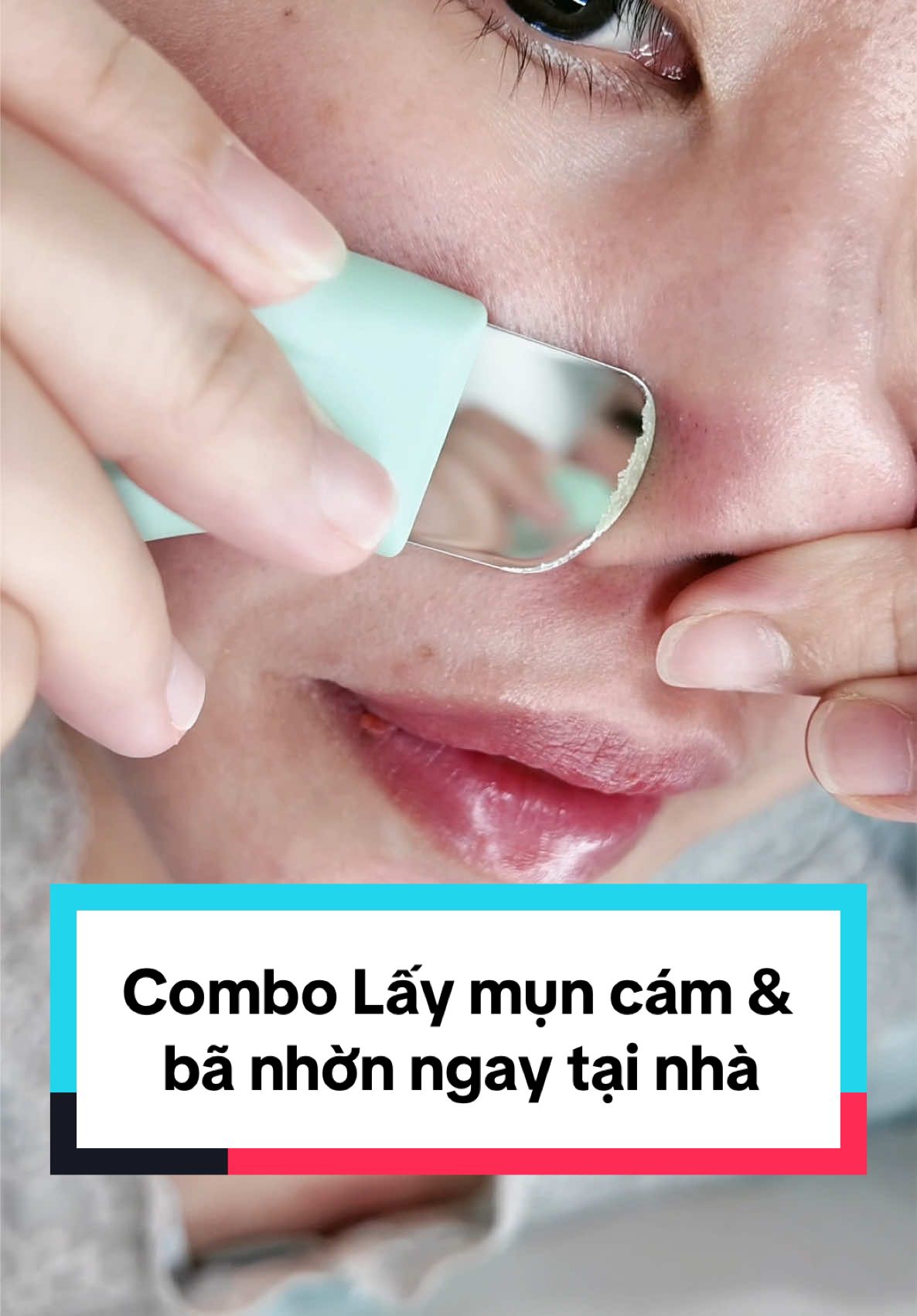 Set ủ mụn cám, đẩy bã nhờn ngay tại nhà rất dễ làm luôn các pà. #muncam #mundauden #mundaudenmui #laymun #thanhdaymunilso #ongmybamup #mymupreview #mymupdaily 