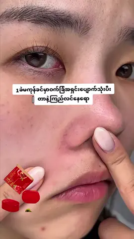 #hcသလဲသီးမျက်နှာသစ် #ဝက်ခြံပျောက်ခြင်သူများ #fpyシ #fpyシ❥tiktok🖤🌹 #fypシ゚viral #fpyyyyyyyyy #fppppppppppppppppppppppp❤️ #fyp #foryou #foryoupage #fy #fypシ゚viral 