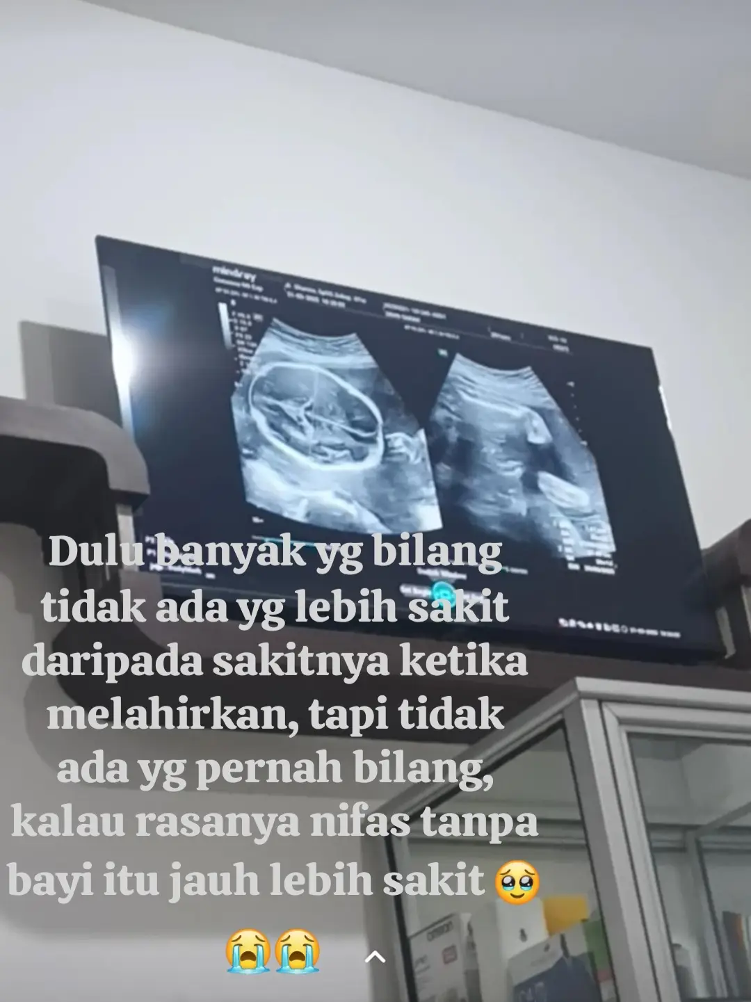 kuatkan aku ya allah 🥹 #Bayisurgaku 