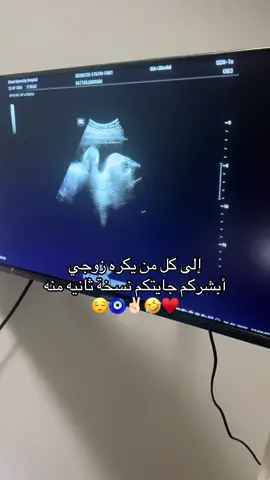 #ابني_هيل_وفستقة_واحلى_ولد_بالمنطقة #زوجي #ترند #اكسبلور #شعب_الصيني_ماله_حل😂😂 
