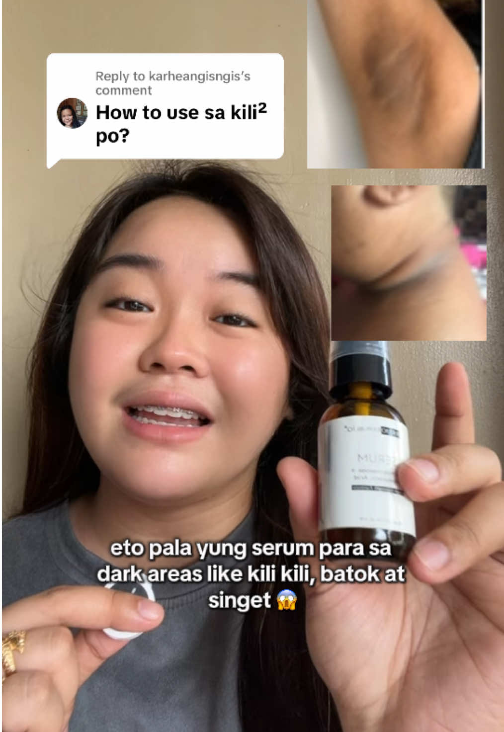Replying to @karheangisngis use serum consistently everyday, apply appropriate amount sa dark areas like kili kili, batok and singet  #dermorepubliq #dermorepubliqserum #serumviral #serum 