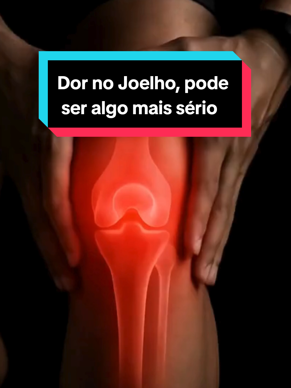 Dor no Joelho, fique atento, pode ser algo mais sério do que você imagina. #joelho #dornojoelho #artrite 