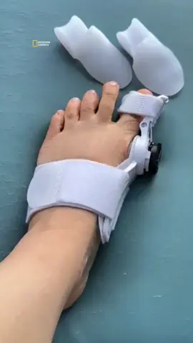 Try this Bunion Corrector #bunioncorrector #tiktokshop #fyp 