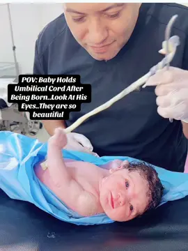 Baby Holds Umbilical Cord After Being Born..His Eyes Are Beautiful #newbornbaby #laboranddelivery #umblicalcord #prettyeyes #relatable #wegoingviraltoday #viralcontent 
